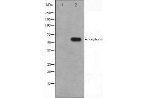Western blot analysis on HepG2 cell lysate using Peripherin Antibody,The lane on the left is treated with the antigen-specific peptide. (Peripherin Antikörper  (C-Term))