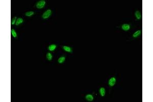 Immunofluorescence staining of Hela with ABIN7127738 at 1:100,counter-stained with DAPI. (Rekombinanter RAF1 Antikörper  (pSer43))