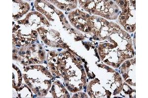 Immunohistochemical staining of paraffin-embedded liver tissue using anti-NPR3mouse monoclonal antibody. (NPR3 Antikörper)