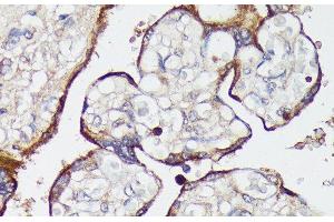 Immunohistochemistry of paraffin-embedded Human placenta using SLC7A2 Polyclonal Antibody at dilution of 1:100 (40x lens). (SLC7A2 Antikörper)