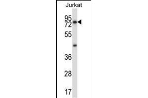 MCOLN1 Antibody (C-term) (ABIN657474 and ABIN2846502) western blot analysis in Jurkat cell line lysates (35 μg/lane).
