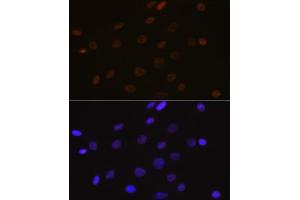 Immunofluorescence analysis of C6 cells using DEK Rabbit mAb (ABIN7266724) at dilution of 1:100 (40x lens). (DEK Antikörper)