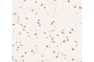 Immunohistochemistry analysis of paraffin-embedded mouse brain using,PRR14 (ABIN7075196) at dilution of 1: 3200 (PRR14 Antikörper)