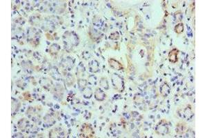 Immunohistochemistry of paraffin-embedded human salivary gland tissue using ABIN7157845 at dilution of 1:100 (EPM2A Antikörper  (AA 244-331))