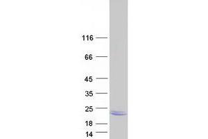 Validation with Western Blot (LEMD1 Protein (Myc-DYKDDDDK Tag))