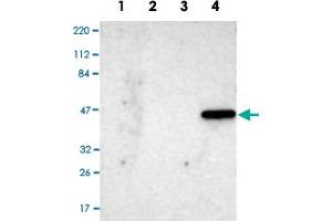 Western Blot analysis of Lane 1: RT-4 cell, Lane 2: U-251 MG sp cell, Lane 3: human plasma tissue (IgG/HSA depleted) and Lane 4: human liver tissue lysates with IL17RB polyclonal antibody . (IL17 Receptor B Antikörper)