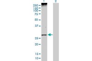 Western Blot analysis of PHLDA1 expression in transfected 293T cell line by PHLDA1 MaxPab polyclonal antibody. (PHLDA1 Antikörper  (AA 1-259))