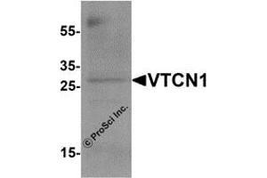 Western Blotting (WB) image for anti-V-Set Domain Containing T Cell Activation Inhibitor 1 (VTCN1) antibody (ABIN1077428) (VTCN1 Antikörper)