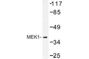 Image no. 1 for anti-Mitogen-Activated Protein Kinase Kinase 1 (MAP2K1) antibody (ABIN317881) (MEK1 Antikörper)