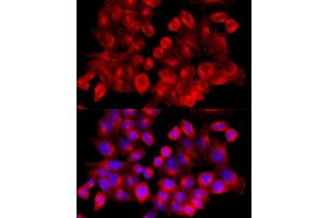 Immunofluorescence analysis of HeLa cells using Clathrin heavy chain antibody (ABIN6131586, ABIN6138752, ABIN6138754 and ABIN6216041) at dilution of 1:100 (40x lens). (Clathrin Heavy Chain (CLTC) (AA 1451-1675) Antikörper)