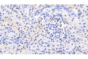 Immunohistochemistry (IHC) image for anti-Endothelial PAS Domain Protein 1 (EPAS1) (AA 339-541) antibody (ABIN7435523)