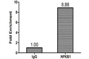 Immunohistochemistry (IHC) image for anti-Nuclear Factor of kappa Light Polypeptide Gene Enhancer in B-Cells 1 (NFKB1) (AA 1-961) antibody (ABIN7161781)
