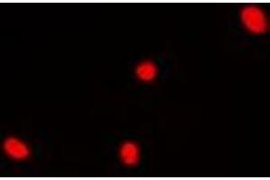 Immunofluorescent analysis of DDX41 staining in Hela cells. (DDX41 Antikörper)