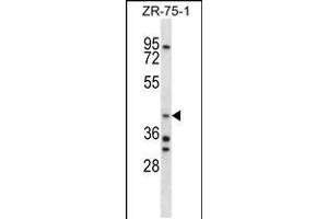 Western blot analysis in ZR-75-1 cell line lysates (35ug/lane). (AIP Antikörper  (C-Term))