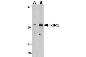 Image no. 1 for anti-Plexin Domain Containing 2 (PLXDC2) (N-Term) antibody (ABIN1494345) (PLXDC2 Antikörper  (N-Term))