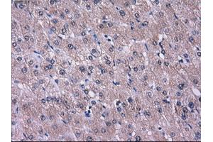 Immunohistochemical staining of paraffin-embedded liver tissue using anti-L1CAMmouse monoclonal antibody.