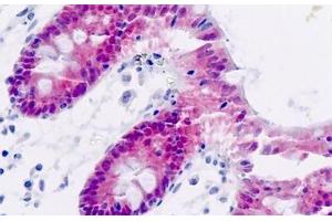 anti-Aldo-Keto Reductase Family 7, Member A3 (Aflatoxin Aldehyde Reductase) (AKR7A3) antibody
