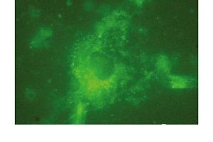 Immunofluorescence (IF) image for anti-Lysosomal-Associated Membrane Protein 2 (LAMP2) antibody (ABIN7211532) (LAMP2 Antikörper)