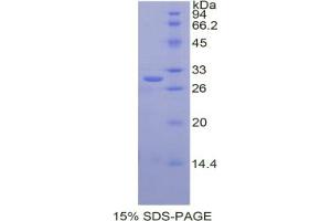 SDS-PAGE analysis of Human Cathepsin C Protein. (CTSC Protein)