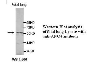 Image no. 1 for anti-Angiopoietin 4 (ANGPT4) (Internal Region) antibody (ABIN791095)