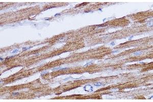 Immunohistochemistry of paraffin-embedded Rat heart using NDUFB7 Polyclonal Antibody at dilution of 1:100 (40x lens).