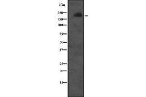 Western blot analysis of CUL7 expression in Molt-4 cell lysate ;,The lane on the left is treated with the antigen-specific peptide. (Cullin 7 Antikörper  (C-Term))
