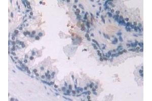 Immunohistochemistry (IHC) image for anti-Endoglin (ENG) (AA 26-136) antibody (ABIN7438025)