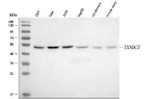 Western blot analysis of TXNDC5 using anti-TXNDC5 antibody (ABIN7599699).