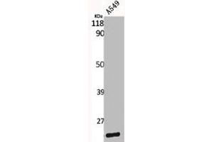 Western Blot analysis of A549 cells using Caveolin-1 Polyclonal Antibody (Caveolin-1 Antikörper  (C-Term))