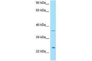 Western Blotting (WB) image for anti-Neurturin (NRTN) (C-Term) antibody (ABIN2774377) (Neurturin Antikörper  (C-Term))