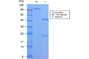 SDS-PAGE Analysis Purified HLA-DQ Rabbit Recombinant Monoclonal Ab (HLA-DQA1/2866R).