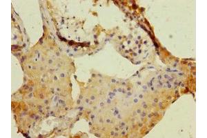 Immunohistochemistry of paraffin-embedded human testis tissue using ABIN7150689 at dilution of 1:100 (DUOX1 Antikörper  (AA 1312-1551))