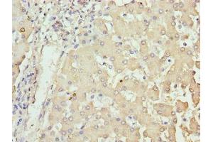 Immunohistochemistry of paraffin-embedded human liver tissue using ABIN7162026 at dilution of 1:100 (NUPL2 Antikörper  (AA 1-224))