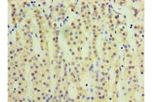 Immunohistochemistry of paraffin-embedded human adrenal gland tissue using ABIN7170753 at dilution of 1:100 (CYP17A1 Antikörper  (AA 24-508))
