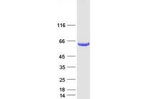 Western Blotting (WB) image for Interferon Regulatory Factor 5 (IRF5) (Transcript Variant 4) protein (Myc-DYKDDDDK Tag) (ABIN2723541)