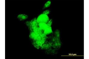 Immunofluorescence of monoclonal antibody to SMOC1 on A-431 cell. (SMOC1 Antikörper  (AA 150-221))
