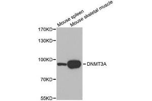 Western blot analysis of extracts of various tissues, using DNMT3A antibody. (DNMT3A Antikörper)