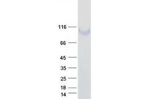 Western Blotting (WB) image for Integrin beta 1 (ITGB1) (Transcript Variant 1A) protein (Myc-DYKDDDDK Tag) (ABIN2713610)