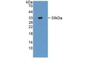 Detection of Recombinant OAS1, Rat using Polyclonal Antibody to 2',5'-Oligoadenylate Synthetase 1 (OAS1) (OAS1 Antikörper  (AA 139-358))