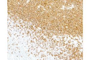 Immunohistochemistry (IHC) image for anti-Fluorescein Isothiocyanate (FITC) antibody (ABIN7795713) (Rekombinanter FITC Antikörper)