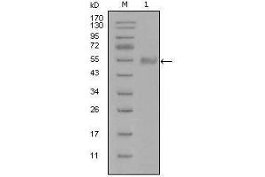 Western blot analysis using SYT1 mouse mAb against truncated Trx-SYT1 recombinant protein (1). (SYT1 Antikörper)