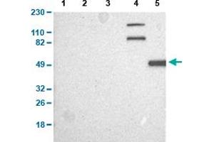Western Blot analysis of (1) human cell line RT-4, (2) human cell line U-251MG sp, (3) human plasma (IgG/HSA depleted), (4) human liver tissue, and (5) human tonsil tissue. (CAPN10 Antikörper  (AA 146-245))