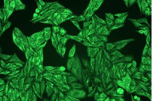 Immunocytochemistry staining of cytokeratins in Hep-2 cells using pan-cytokeratin antibody C-11 ((ABIN94275), diluted 1:400), detected with GAM IgG-Alexa Fluor488 (diluted 1:200, green).