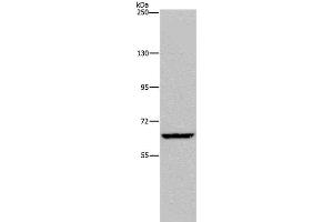 Western Blot analysis of Hela cell using IVL Polyclonal Antibody at dilution of 1:200 (Involucrin Antikörper)