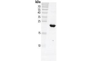 Polybromo 1 Protein (PBRM1) (AA 613-734) (His tag,DYKDDDDK Tag)