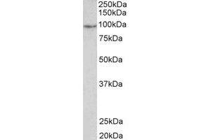 Western Blotting (WB) image for anti-phosphodiesterase 4B, cAMP-Specific (PDE4B) (C-Term) antibody (ABIN2464994) (PDE4B Antikörper  (C-Term))