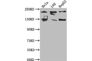 Western Blot Positive WB detected in: Hela whole cell lysate, L02 whole cell lysate, HepG2 whole cell lysate All lanes: MGEA5 antibody at 1:1000 Secondary Goat polyclonal to rabbit IgG at 1/50000 dilution Predicted band size: 103, 96, 77, 97 kDa Observed band size: 130 kDa (Rekombinanter MGEA5 Antikörper)