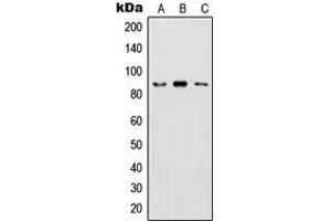 Western blot analysis of IKK beta (pY199) expression in HeLa LPS-treated (A), Raw264. (IKBKB Antikörper  (pTyr199))