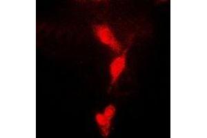 Immunofluorescent analysis of CDC34B staining in MCF7 cells. (UBE2R2 Antikörper)