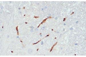 Immunohistochemistry of paraffin-embedded Mouse spinal cord using Phospho-eNOS(S1177) Polyclonal Antibody at dilution of 1:200 (40x lens). (ENOS Antikörper  (pSer1177))